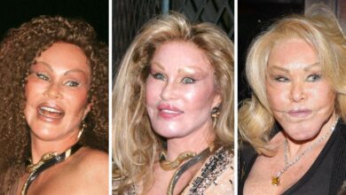 Jocelyn Wildenstein's Transformation Gallery: Before and After Photos