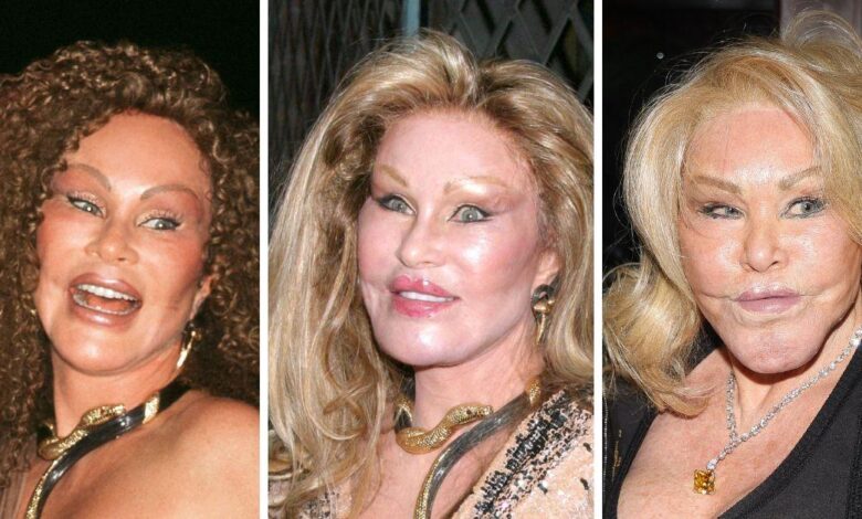 Jocelyn Wildenstein's Transformation Gallery: Before and After Photos