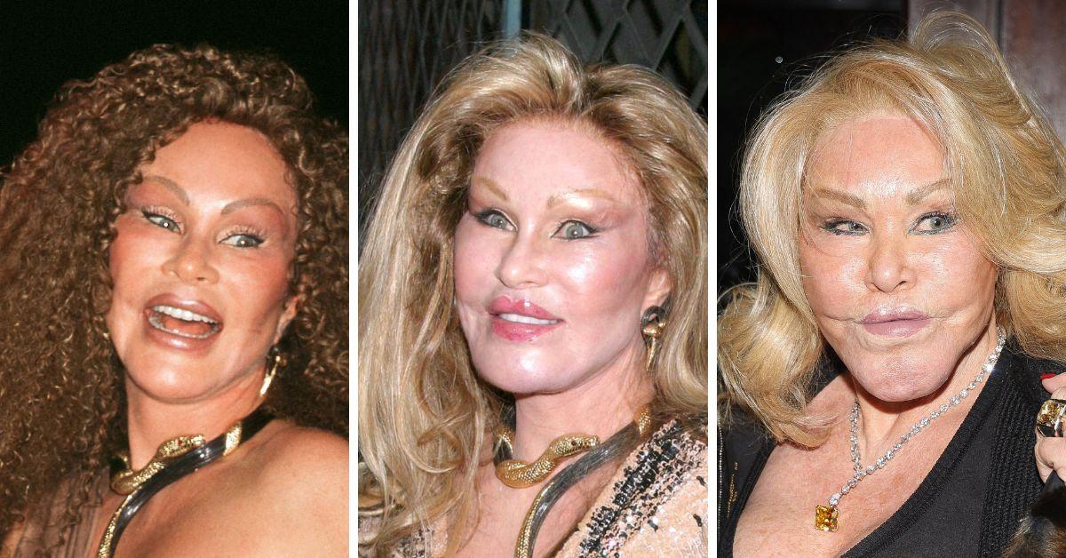 Jocelyn Wildenstein's Transformation Gallery: Before and After Photos