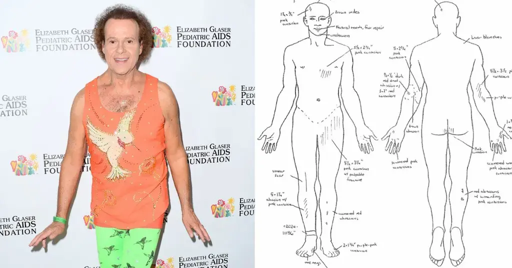 Richard Simmons' autopsy shows his corpse 'littered with abrasions'