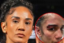 Amanda Serrano shares gruesome injury photo after loss to Katie Taylor