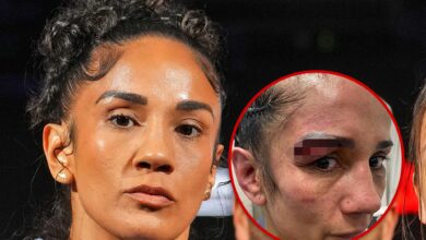 Amanda Serrano shares gruesome injury photo after loss to Katie Taylor