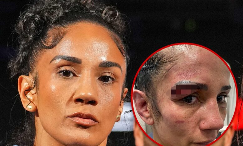 Amanda Serrano shares gruesome injury photo after loss to Katie Taylor