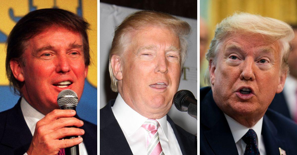 Donald Trump's hair transformation: before and after photos