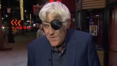 Jay Leno sports eye patch and gruesome bruises after a downhill run