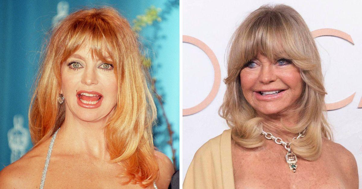 Had Goldie Hawn plastic surgery? What she said about aging