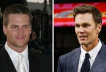 Has Tom Brady received plastic surgery? Rumor