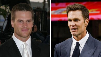 Has Tom Brady received plastic surgery? Rumor