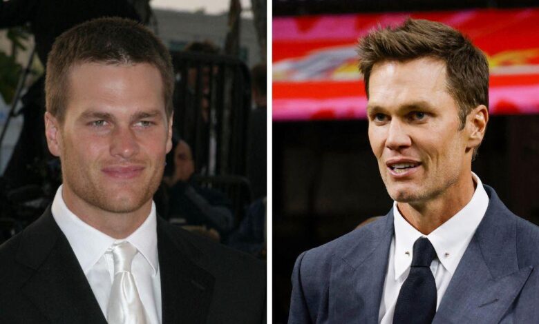 Has Tom Brady received plastic surgery? Rumor