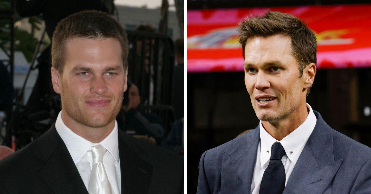 Has Tom Brady received plastic surgery? Rumor