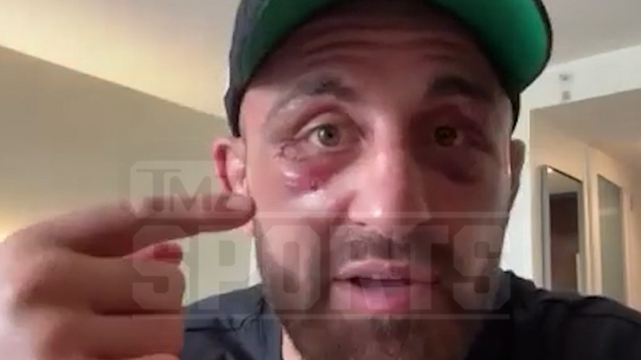 Alex Volkanovski, fresh from UFC 314 win, says 2nd title Run Zoeter than 1st