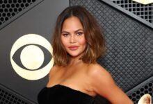 Chrissy Teigen explains Mystery Bandaged Face Procedure