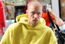Justin Bieber goes on bizarre anger, uses facial filter