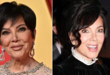 Kylie Jenner's ZalmPerma and surgery 'addiction'