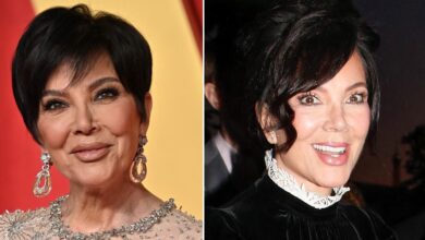 Kylie Jenner's ZalmPerma and surgery 'addiction'
