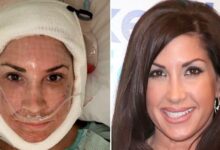 'Real Housewives' Star, 55, places shocking post-on video after facelift