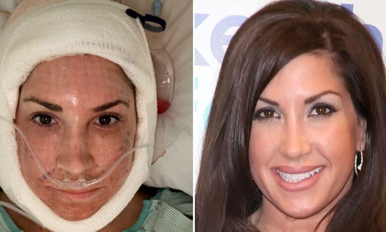 'Real Housewives' Star, 55, places shocking post-on video after facelift
