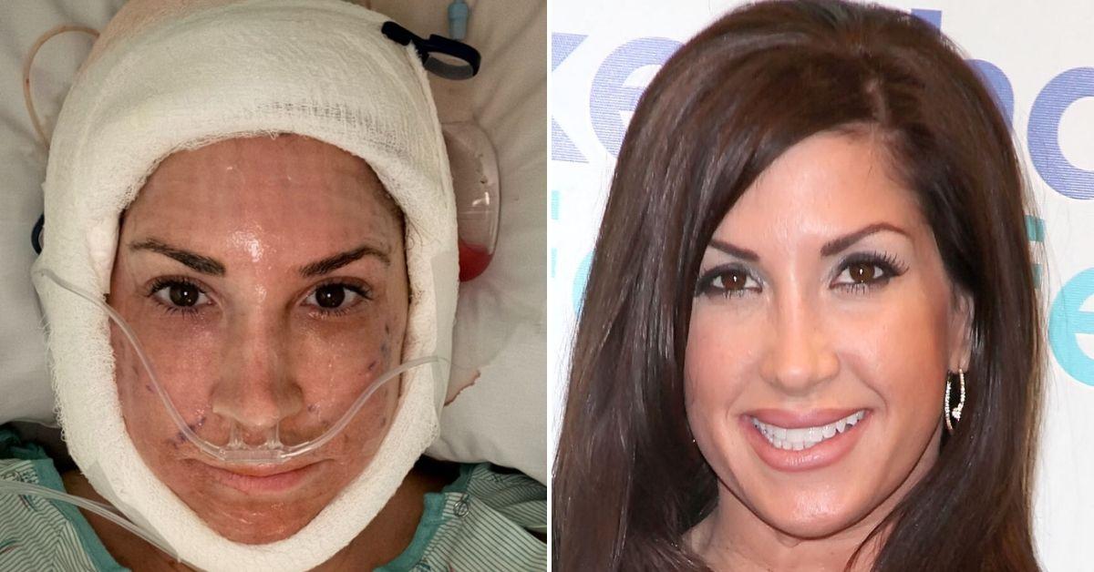 'Real Housewives' Star, 55, places shocking post-on video after facelift