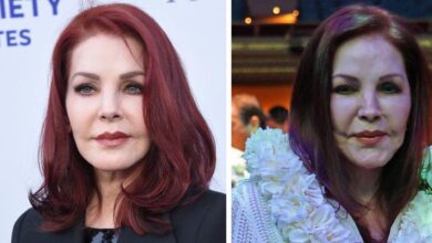 Priscilla Presley's plastic surgery nightmare! Fillers and more