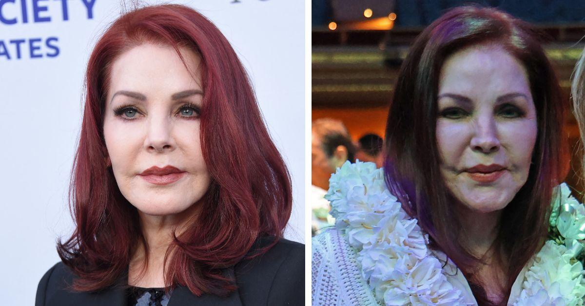 Priscilla Presley's plastic surgery nightmare! Fillers and more