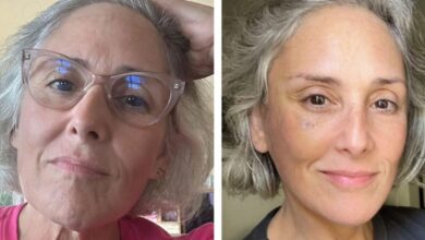 Ricki Lake has neck and facelift after losing 40 pounds