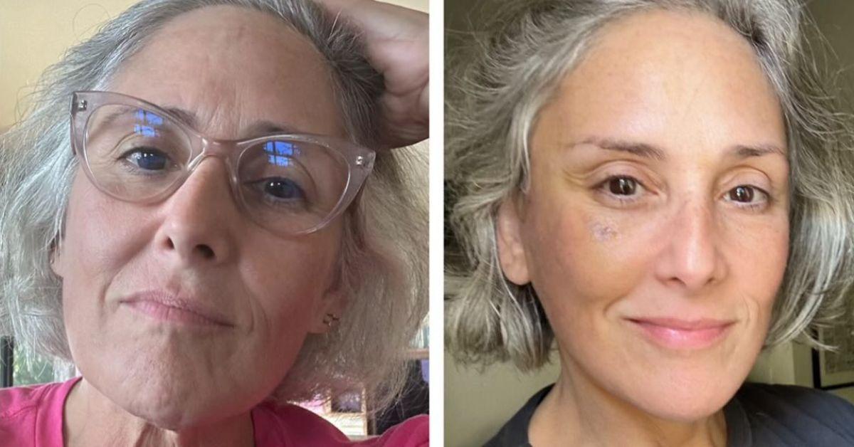 Ricki Lake has neck and facelift after losing 40 pounds
