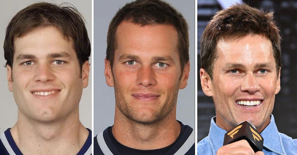 Tom Brady's secret nipple to remove the skin around the eyes