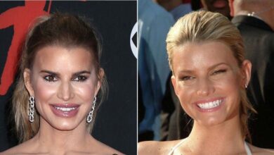 Plastic surgeon reveals secrets behind Jessica Simpson's new face