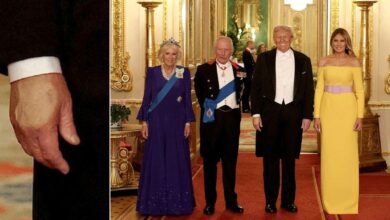 See Donald Trump's desperate attempt to cover bruised hands with Royals