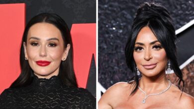 Who has undergone plastic surgery?