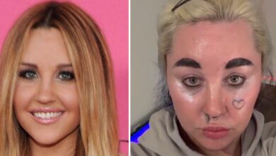 Amanda Bynes looks unrecognizable in new photo after cosmetic work