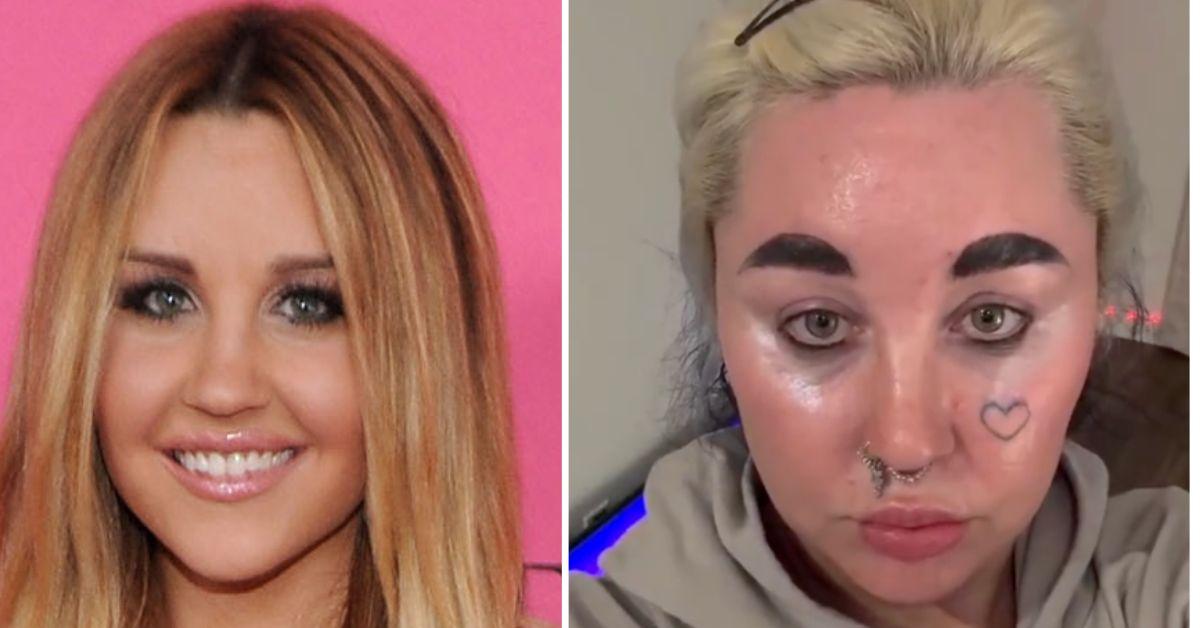 Amanda Bynes looks unrecognizable in new photo after cosmetic work