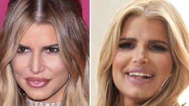 Jessica Simpson's 'exaggerated' facial fillers explained by a plastic surgeon