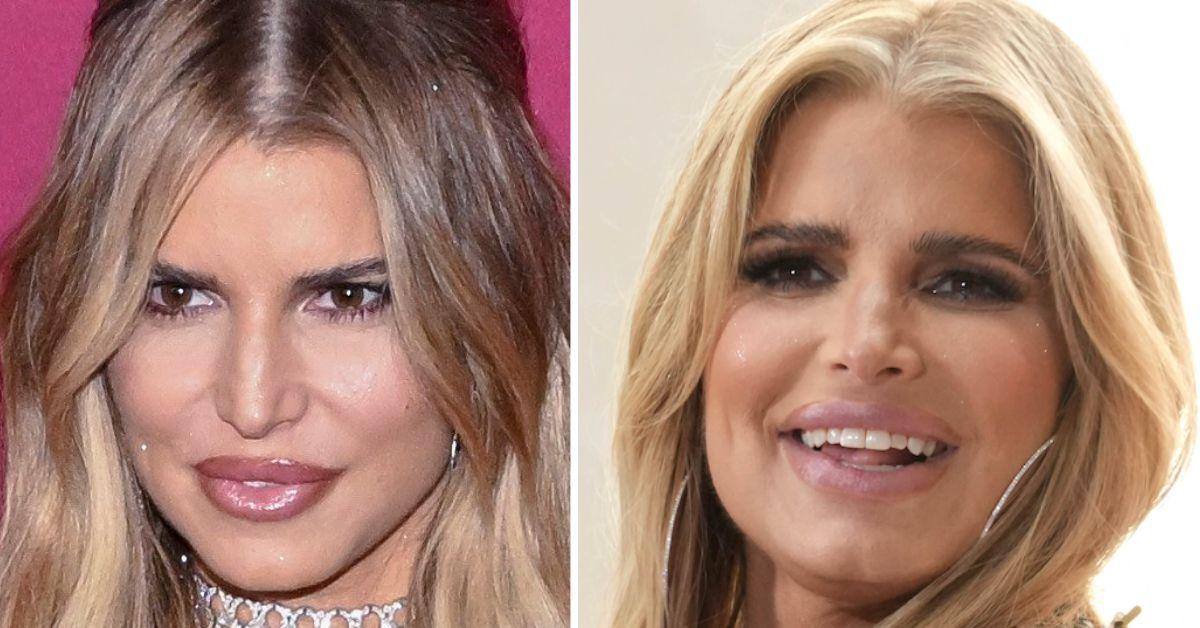 Jessica Simpson's 'exaggerated' facial fillers explained by a plastic surgeon