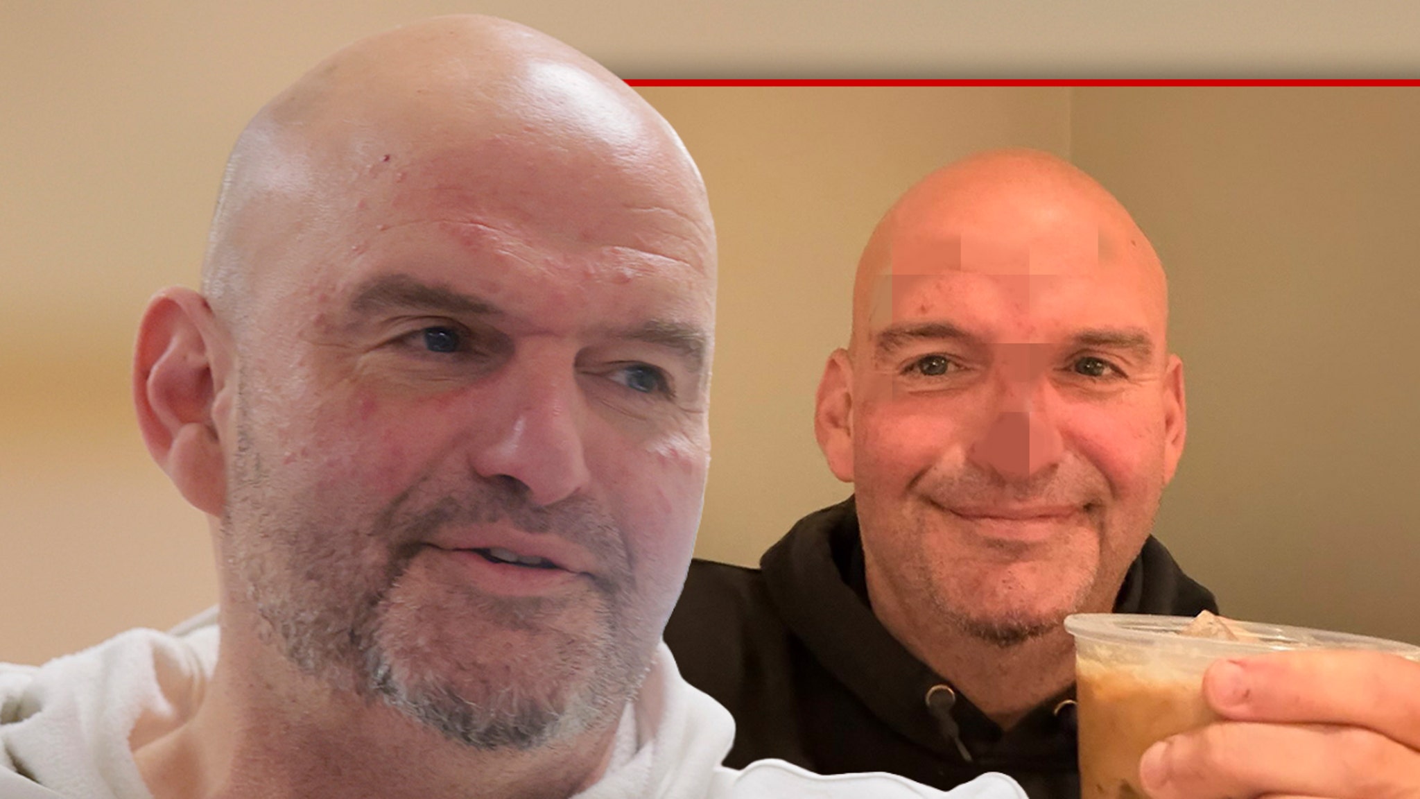 Senator John Fetterman says he needed 20 stitches, shares photo of punched face