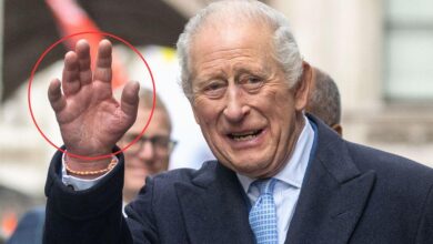 Why King Charles's cancer-fighting fingers are so swollen