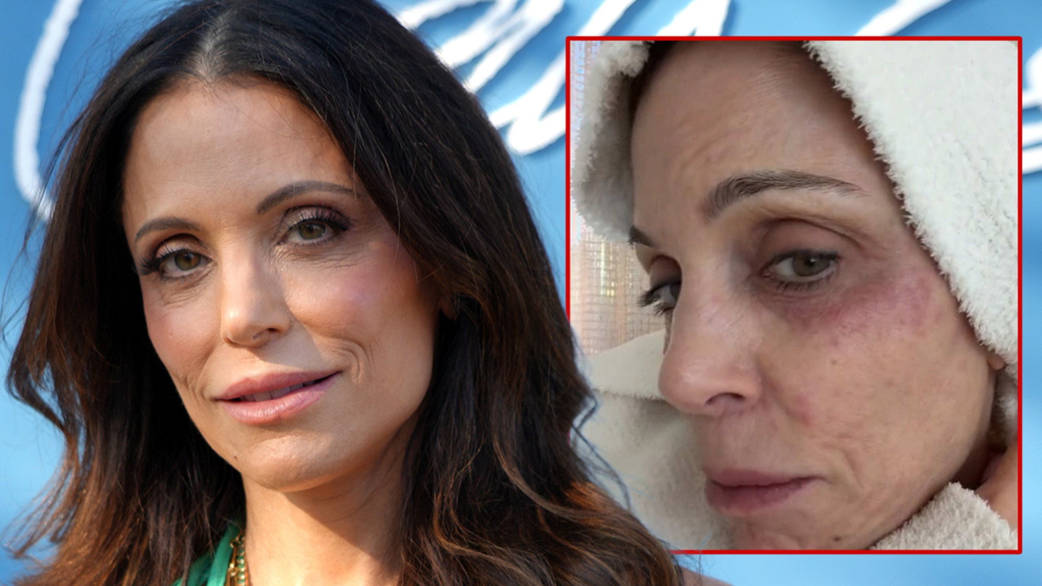 Bethenny Frankel contracts a bacterial infection after a party in St. Barths