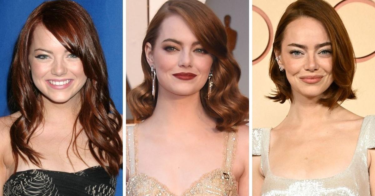 Emma Stone's transformation revealed amid plastic surgery rumors