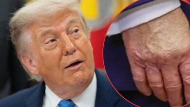 Everything you need to know about Donald Trump's health amid mounting concerns