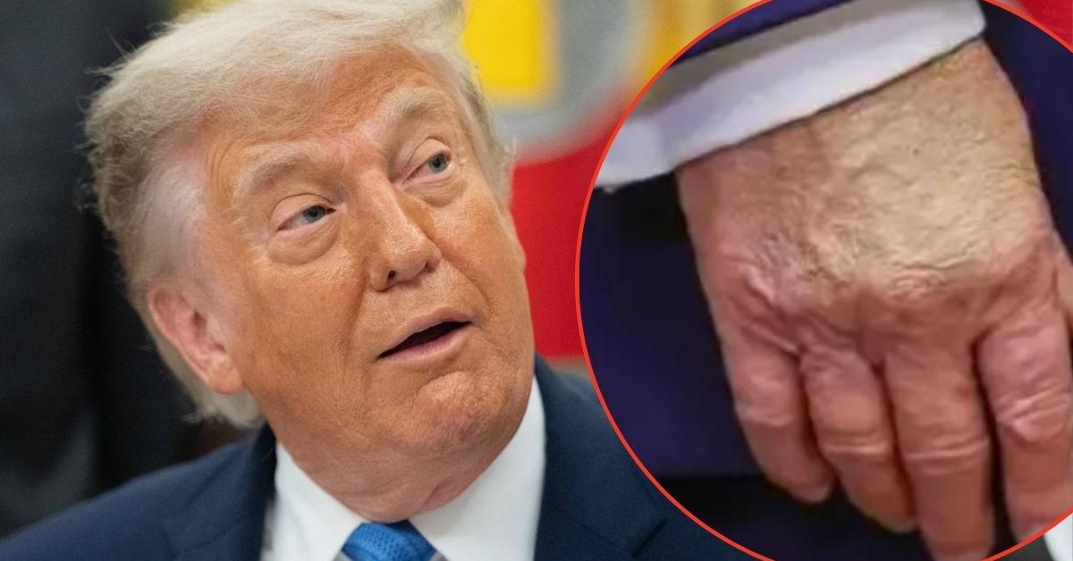 Everything you need to know about Donald Trump's health amid mounting concerns