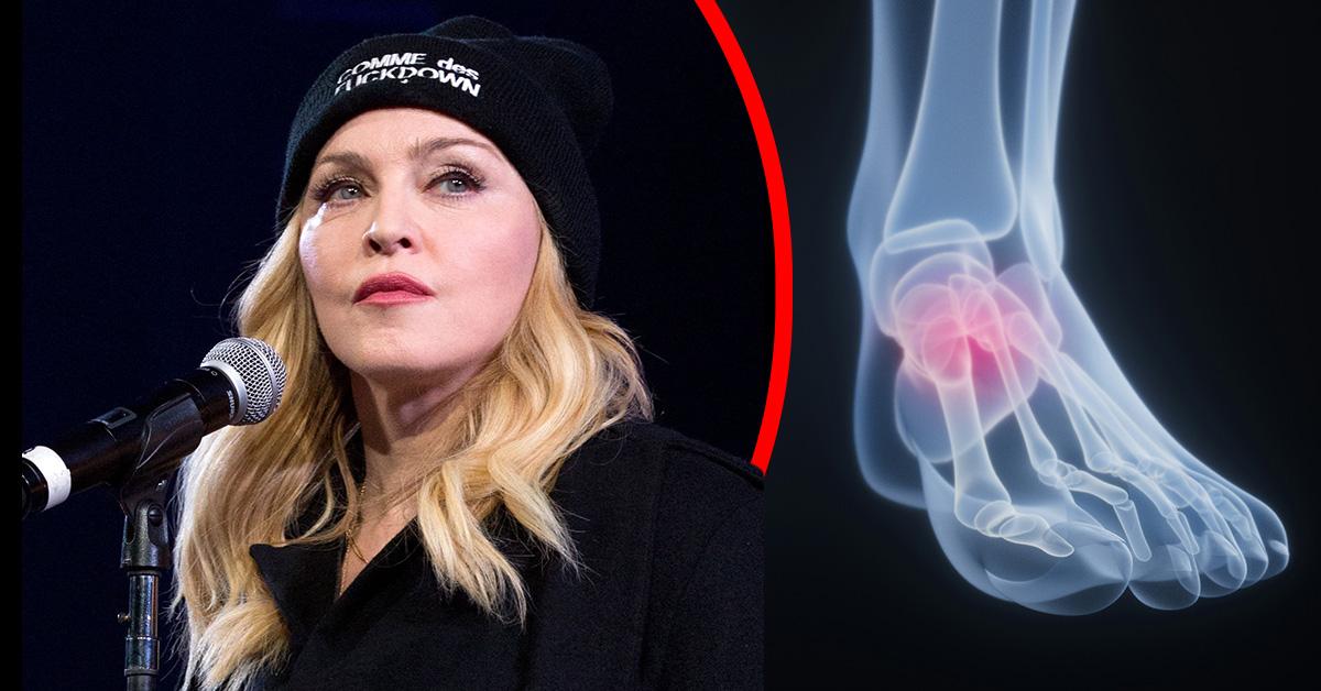 Madonna creates fear of retirement while the bones suffer