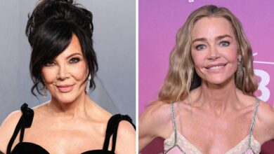 Radar reveals the most shocking celebrity facelift transformations