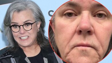 Rosie O'Donnell lifts the lid on future post-facelift surgery plans