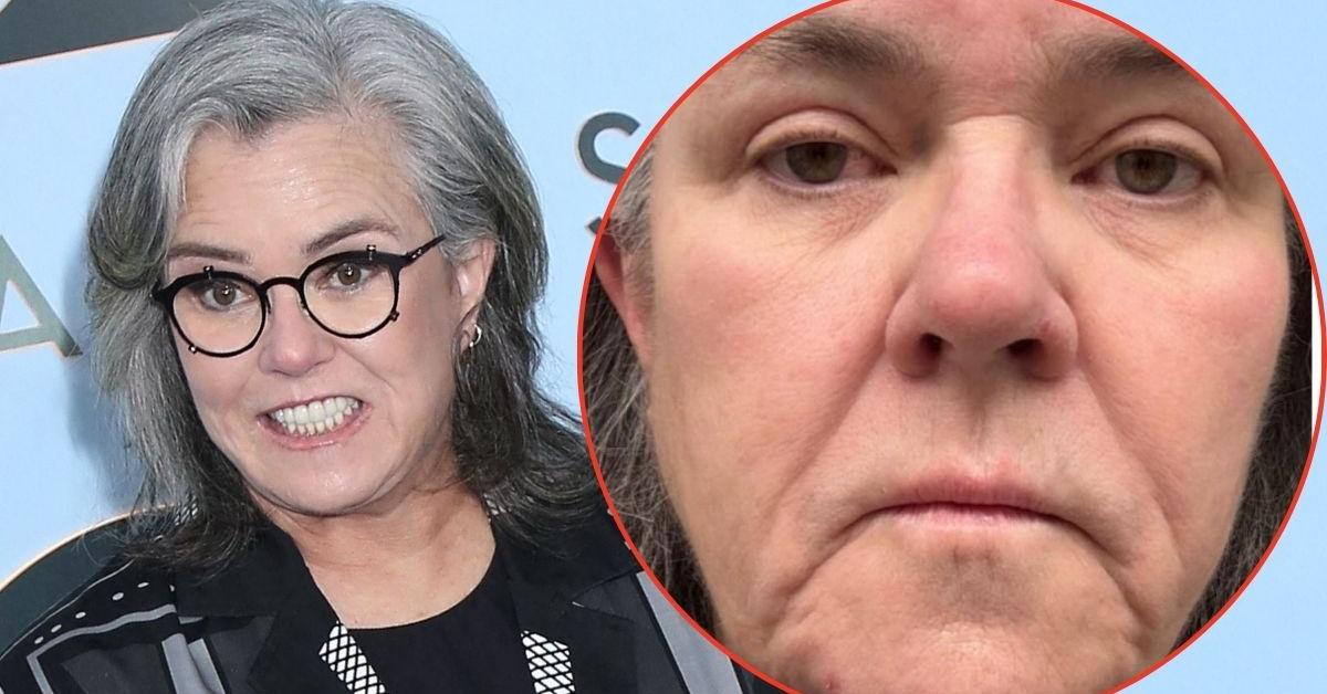 Rosie O'Donnell lifts the lid on future post-facelift surgery plans