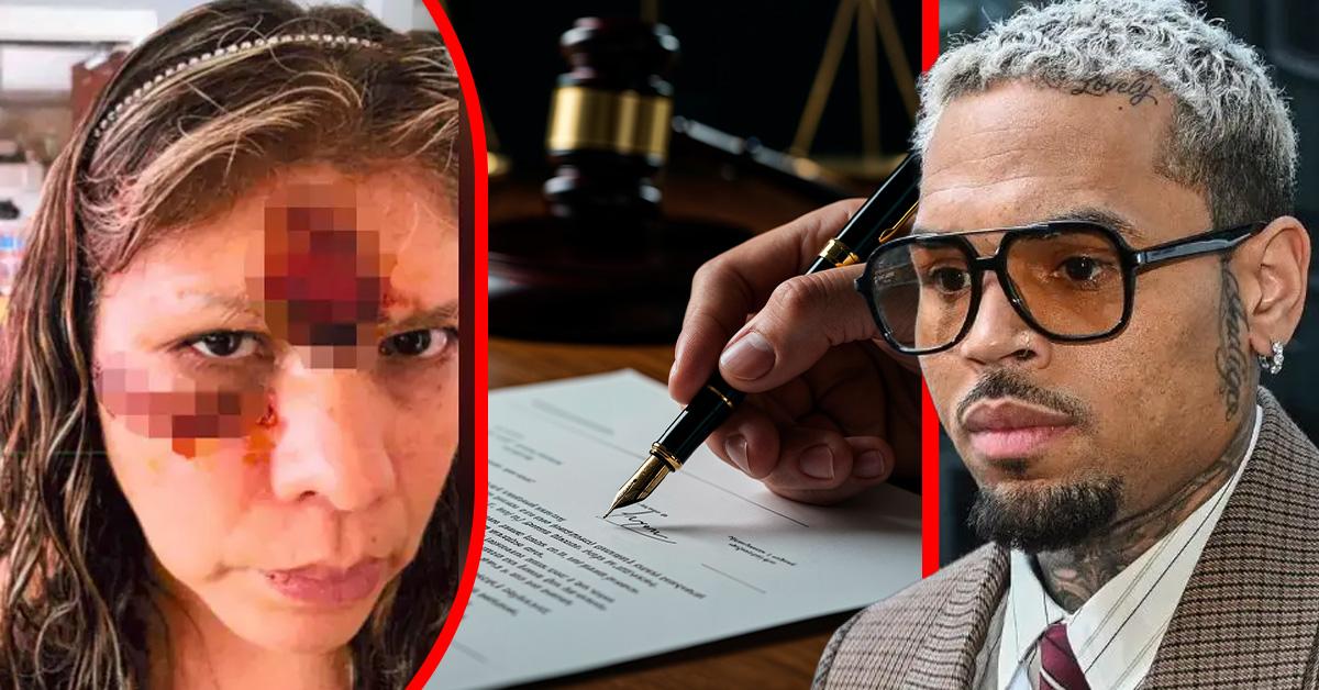Chris Brown's housekeeper's husband gets $50,000 in dog attack case