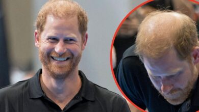 Prince Harry Faces Fresh Bald Mockery After Hair Comments