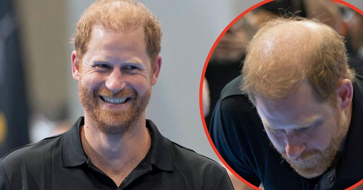 Prince Harry Faces Fresh Bald Mockery After Hair Comments